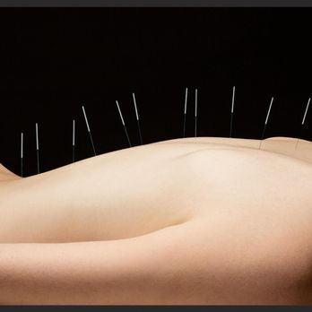 Golden Way Clinic - Acupuncture Near Me - Ashland, Oregon Golden Way Clinic - Acupuncture Near Me - Ashland, Oregon