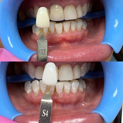 Platinum Smiles