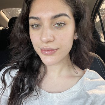 Bombshell Aesthetics - 1 HOUR AFTER - Medical Spas Near Me - Hayward, California Bombshell Aesthetics - 1 HOUR AFTER - Medical Spas Near Me - Hayward, California