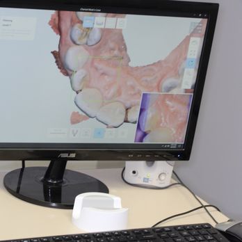 Lif Dental - Digital technology.  Intra-oral scanners are incredibly fast and accurate and NO more goop! - General Dentistry Near Me - Buffalo, New York