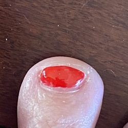 Toe