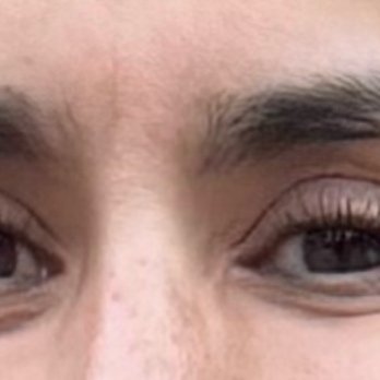 Eyebrow Shapes - brows before she removed too much hair on inner brow causing one brow to start at tear duct which is incorrect placement and looks terrible - Eyebrow Services Near Me - Palmdale, California Eyebrow Shapes - brows before she removed too much hair on inner brow causing one brow to start at tear duct which is incorrect placement and looks terrible - Eyebrow Services Near Me - Palmdale, California