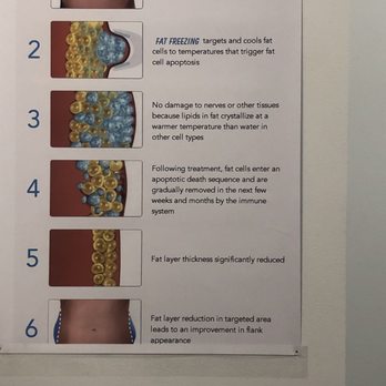 Flip Your Look - Info Sheet - Medical Spas Near Me - Irvine, California