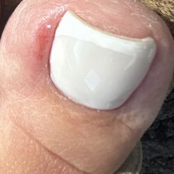 Queen Nails - Toe nail