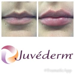 Revitalessence Medical Spa & Laser Center