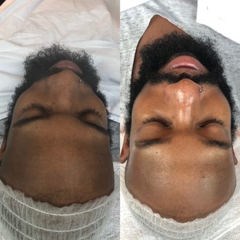 MyeSkin - Aestheticians Near Me - Berwyn Heights, Maryland MyeSkin - Aestheticians Near Me - Berwyn Heights, Maryland