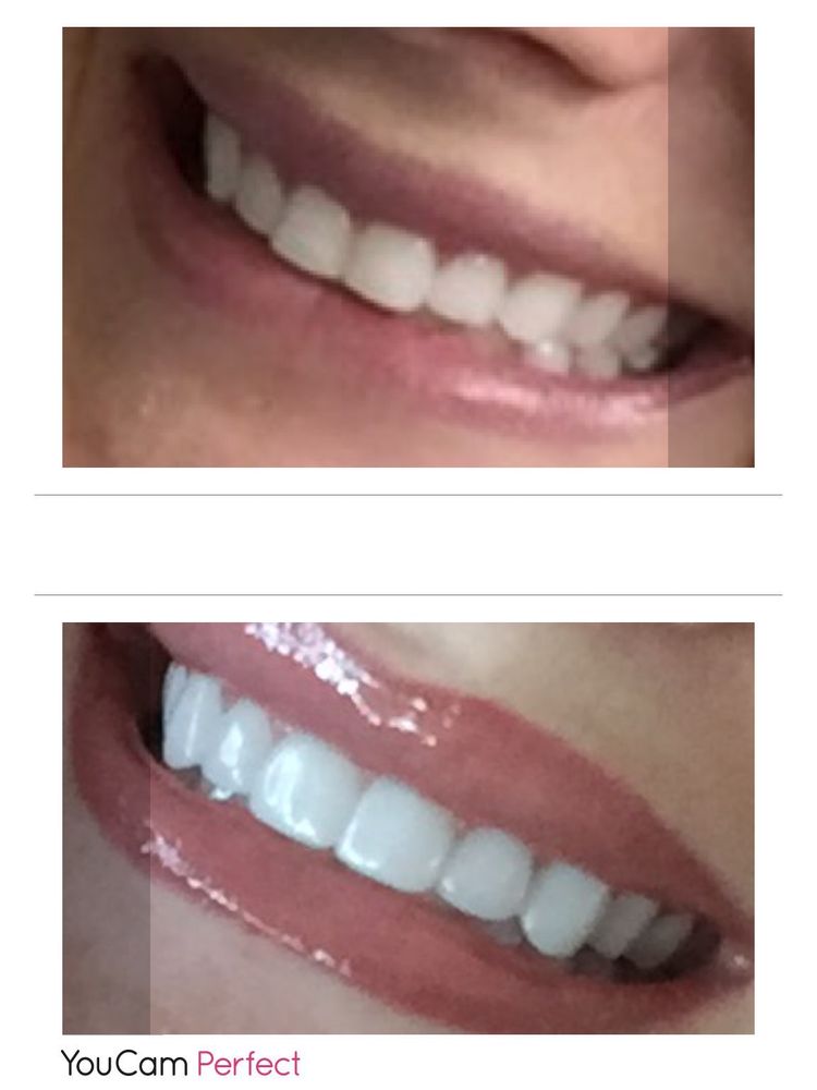 STAR VALLEY DENTAL Updated September 2024 725 N Washington St