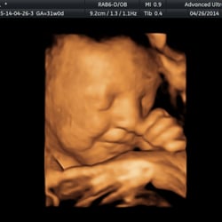 Babies & Bellies 3D/4D Ultrasound Studio & Wellness Spa - Baby loves to smile :)