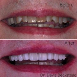 Beckstead Dental Group - Dentist in Palo Alto
BECKSTEAD DENTAL GROUP
1691 EL CAMINO REAL STE 300
PALO ALTO CA 94306
http://becksteaddental.com/