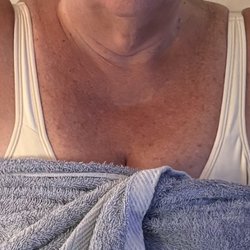 Garber Plastic Surgery - Results