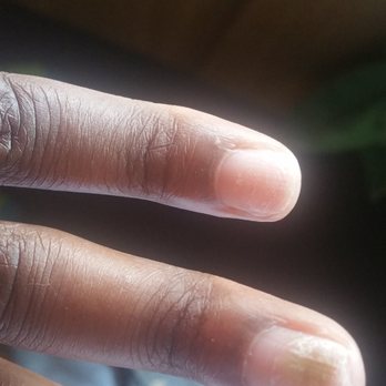 Nails on Fleek - Fungus grow on her nails after taking her tips off - Nail Salons Near Me - Compton, California