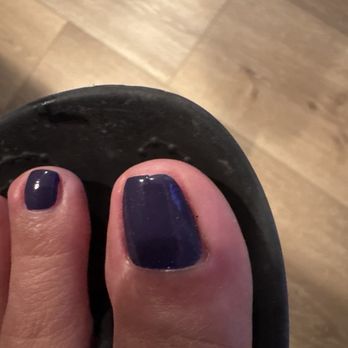 Q Nail Lounge - Clearly swollen in the area she cut and left something behind but refused to touch her horrible work! - Nail Salons Near Me - Downey, California
