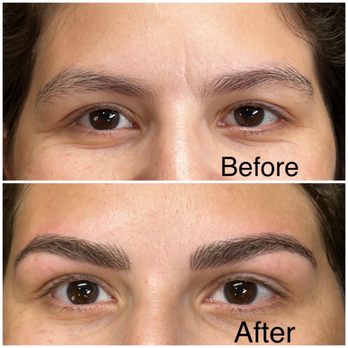 Purposeful Beauty Microblading & Med Spa - Here is my microblading before and after pictures with Alllie Muller in Alpharetta. - Medical Spas Near Me - Alpharetta, Georgia Purposeful Beauty Microblading & Med Spa - Here is my microblading before and after pictures with Alllie Muller in Alpharetta. - Medical Spas Near Me - Alpharetta, Georgia
