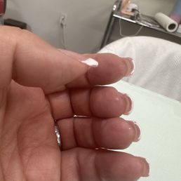 Cindy tried to send me home like this. Look at my thumb! Cindy tried to send me home like this. Look at my thumb!