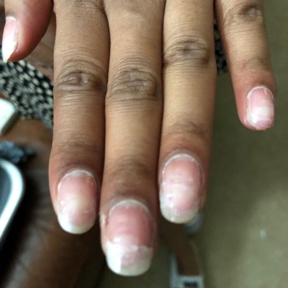 Coco Nails Spa - Middle finger is severely broken and bleeding, pinky finger was also ripped off. - Nail Salons Near Me - Lincoln, California Coco Nails Spa - Middle finger is severely broken and bleeding, pinky finger was also ripped off. - Nail Salons Near Me - Lincoln, California
