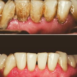 Mile High Hygiene Spa - Take control of your oral health!