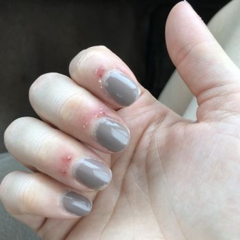 Heights Nail Spa - Here you can see my cuticles peeling from how much she over cut them. They get worse everyday. - Nail Salons Near Me - Houston, Texas