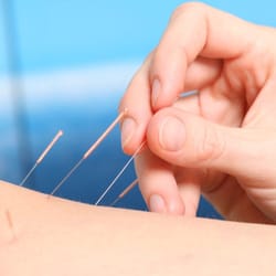 Gong Acupuncture Clinic