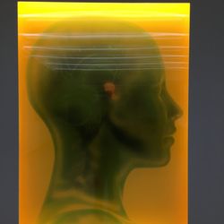 Advanced Neurodiagnostic Center