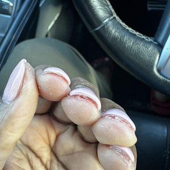 Queen Nail Bar - Did not clean out under my nails after dip. Had to ask her to take off a bunch of dip that was left stuck to the skin on my fingers. - Nail Salons Near Me - Tucker, Georgia Queen Nail Bar - Did not clean out under my nails after dip. Had to ask her to take off a bunch of dip that was left stuck to the skin on my fingers. - Nail Salons Near Me - Tucker, Georgia
