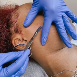 Sassafras Salons - Dermaplaning