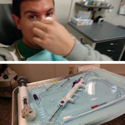 Reston Ear Nose and Throat - In-Office surgery. Clean equipment. Had the sinuplasty and turbinate surgery. About an hour long. No pain, some pressure. Went well :)