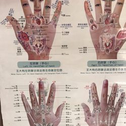 James Zhong - Acupuncture and Herbs