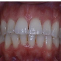 Southern Nevada Orthodontics - After