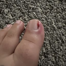 My toe is infected getting my feet done there. I would never go back there and I wouldn't get my feet done there at all. I suggest no one go My toe is infected getting my feet done there. I would never go back there and I wouldn't get my feet done there at all. I suggest no one go