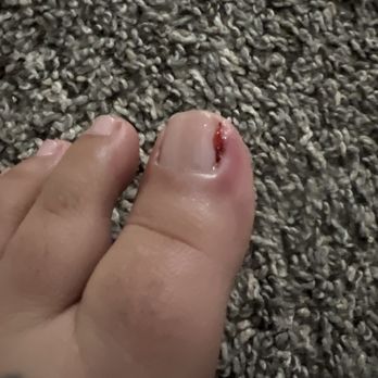 Nails Amour - My toe is infected getting my feet done there. I would never go back there and I wouldn't get my feet done there at all. I suggest no one go - Nail Salons Near Me - San Jose, California Nails Amour - My toe is infected getting my feet done there. I would never go back there and I wouldn't get my feet done there at all. I suggest no one go - Nail Salons Near Me - San Jose, California