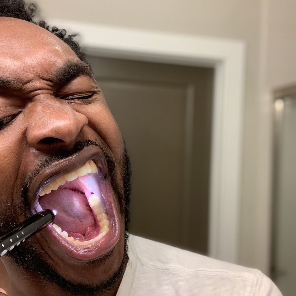 Cinco Meadows Dental - Bottom left Wisdom tooth extraction, but had 4 removed. - General Dentistry Near Me - Katy, Texas Cinco Meadows Dental - Bottom left Wisdom tooth extraction, but had 4 removed. - General Dentistry Near Me - Katy, Texas