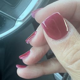 Extremely thick nails Extremely thick nails
