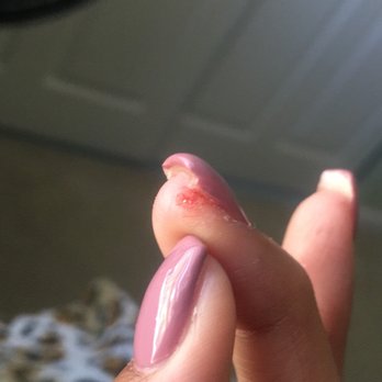 Club Nails - My poor daughter! Look at that cut! Done with an Emory file that they DO NOT sanitize! - Nail Salons Near Me - San Jose, California