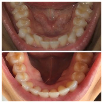Pacific Coast Dentistry - General Dentistry Near Me - Paso Robles, California Pacific Coast Dentistry - General Dentistry Near Me - Paso Robles, California