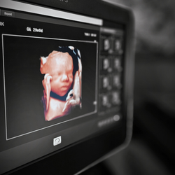 Stork 4D Imaging Studio - 4D ultrasound at 29 weeks pregnant--after hiding behind that hand  you're not going to win here, baby! We finally got a sweet little peek