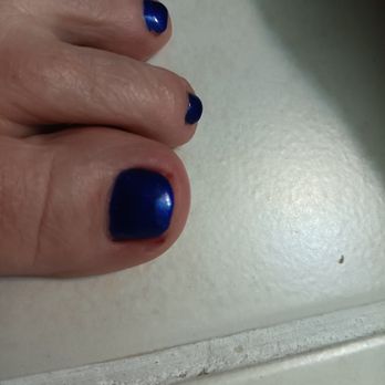 Flagstaff Nails Salon - Bleeding toes, now infected - Nail Salons Near Me - Flagstaff, Arizona