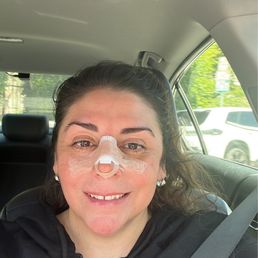 After surgery After surgery
