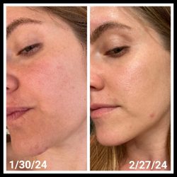 Integrity Skin Care & Wellness - Virtual client before & after