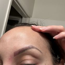 Boleyn studio - Severe redness and scarring 3 weeks after treatment