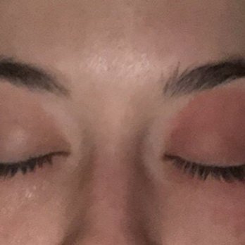 LP Nails & Spa - Both eyes were affected but the left eye the most. Red, swollen, burning. Eating with my hands is a no go - Day Spas Near Me - Orlando, Florida LP Nails & Spa - Both eyes were affected but the left eye the most. Red, swollen, burning. Eating with my hands is a no go - Day Spas Near Me - Orlando, Florida