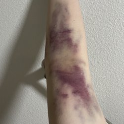 12 hours before a week later