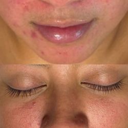 Facials By Alicia
