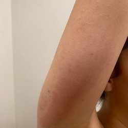Allergy & Asthma Consultants - Redwood City