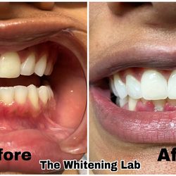 The 20min Whitening Lab. We GUARANTEE results!