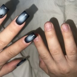 My left hand and ruined nail bed on the right My left hand and ruined nail bed on the right