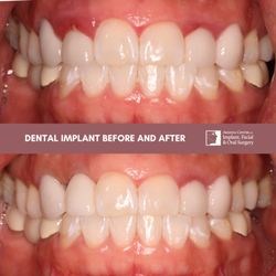 Arizona Center for Oral Surgery