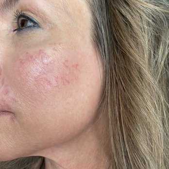 Fae Skin LV - Skin Care Near Me - Las Vegas, Nevada