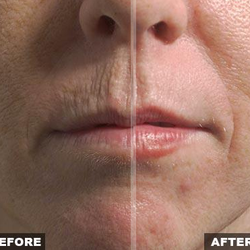 New Seasons of NSB - before and after wrinkles