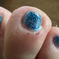 TS Nails - Cut my skin