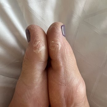 Nail Talk And Tan - Calluses - Nail Salons Near Me - Atlanta, Georgia Nail Talk And Tan - Calluses - Nail Salons Near Me - Atlanta, Georgia
